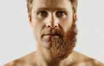 Неравномерно растет борода: причины и способы борьбы с неравномерным ростом бороды